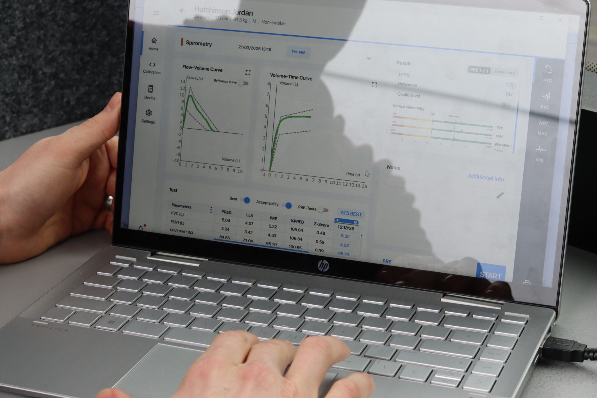 skin surveillance results on laptop