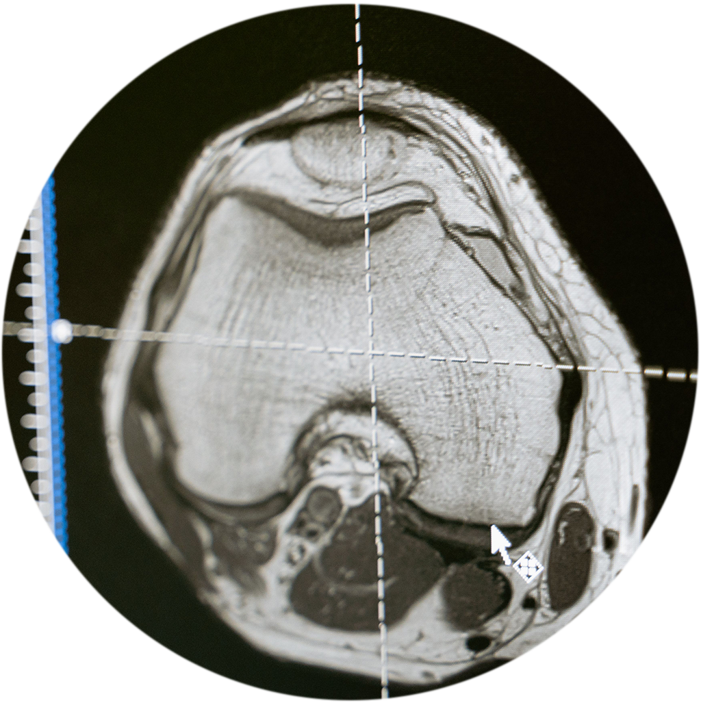 Our diagnostic imaging services give patients access to ultrasound, MRI, X-ray and CT scans that produce the high quality images consultants need to reach a diagnosis. Although each scan is carried out by one of our trusted third-party imaging partners, we help you with your booking, so you're never left chasing appointments yourself.